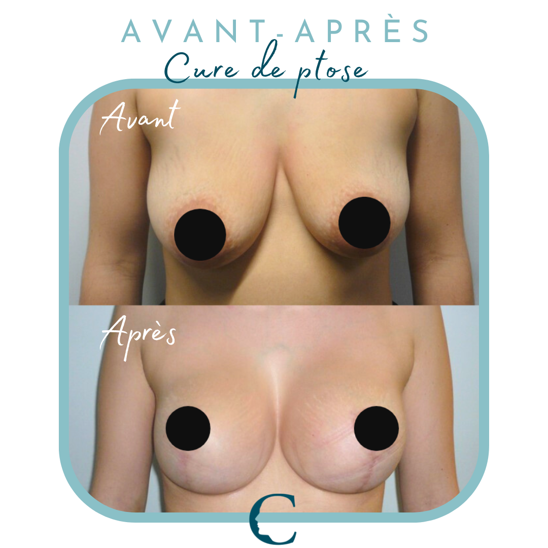 Chirurgie corps Lyon 