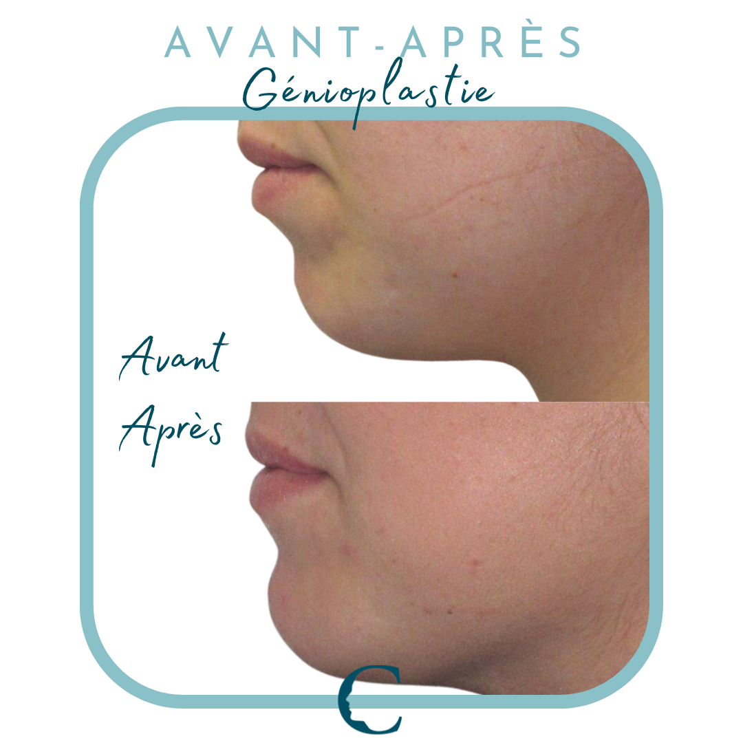 Chirurgie visage Lyon 