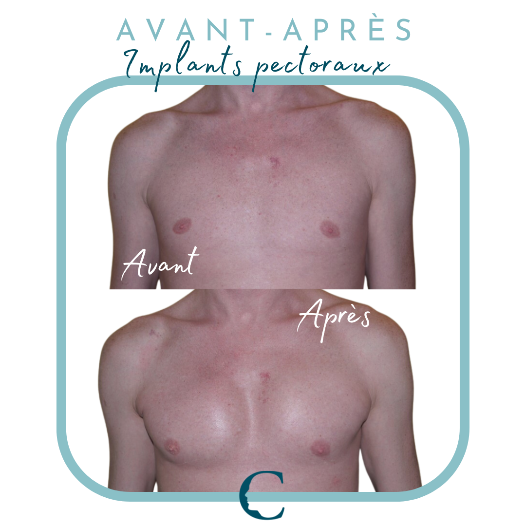 Chirurgie corps Lyon 