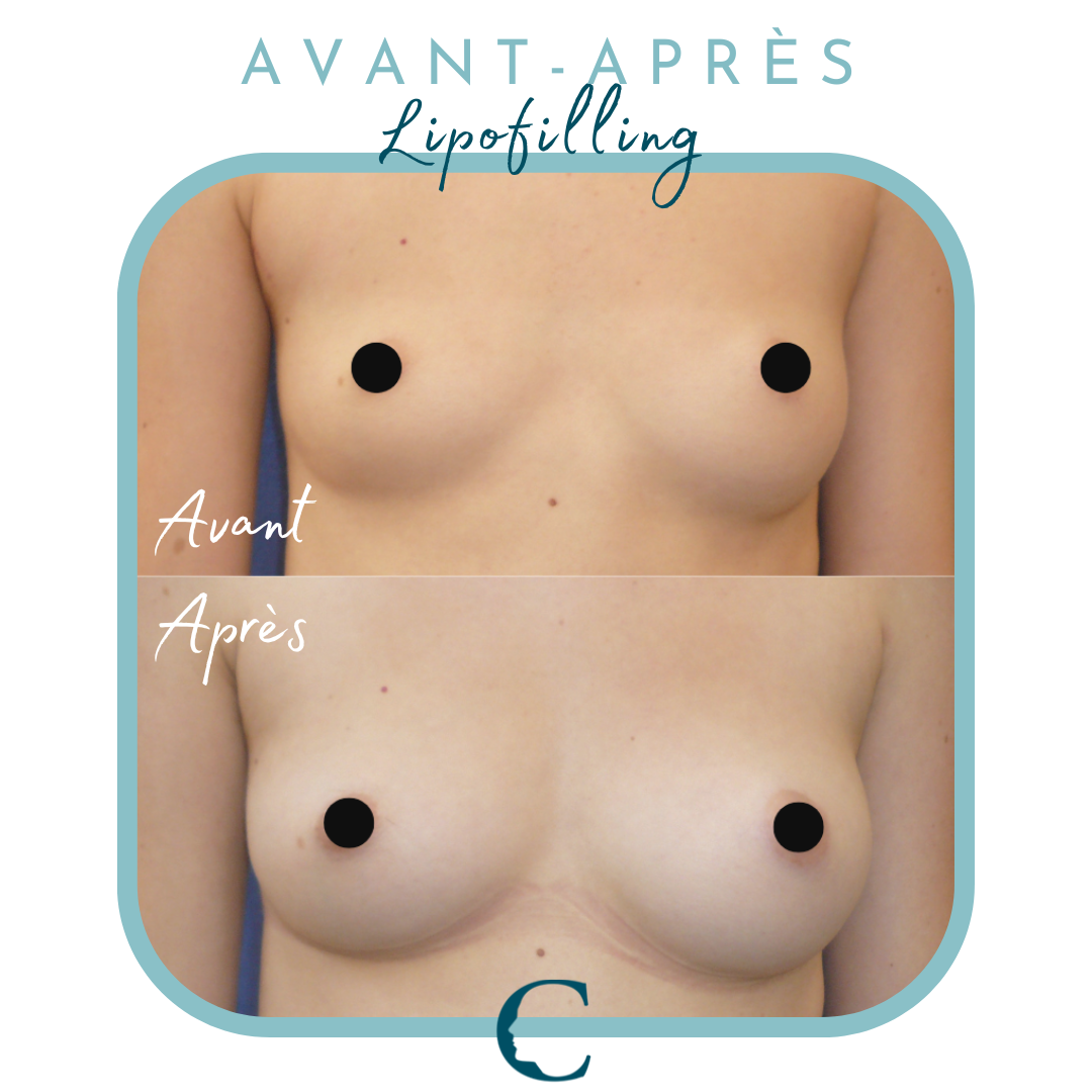 Chirurgie corps Lyon 