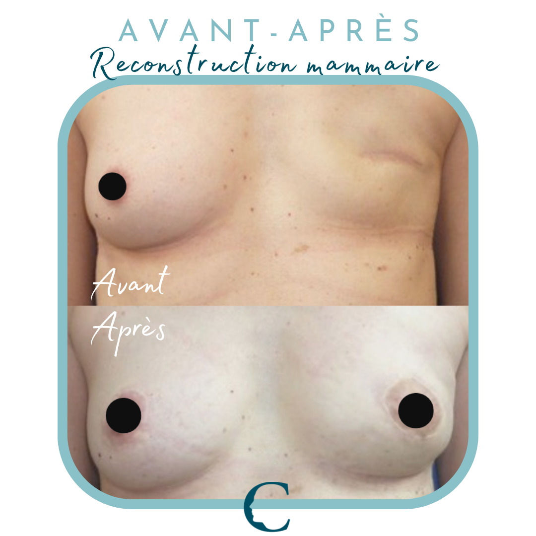 Chirurgie corps Lyon 