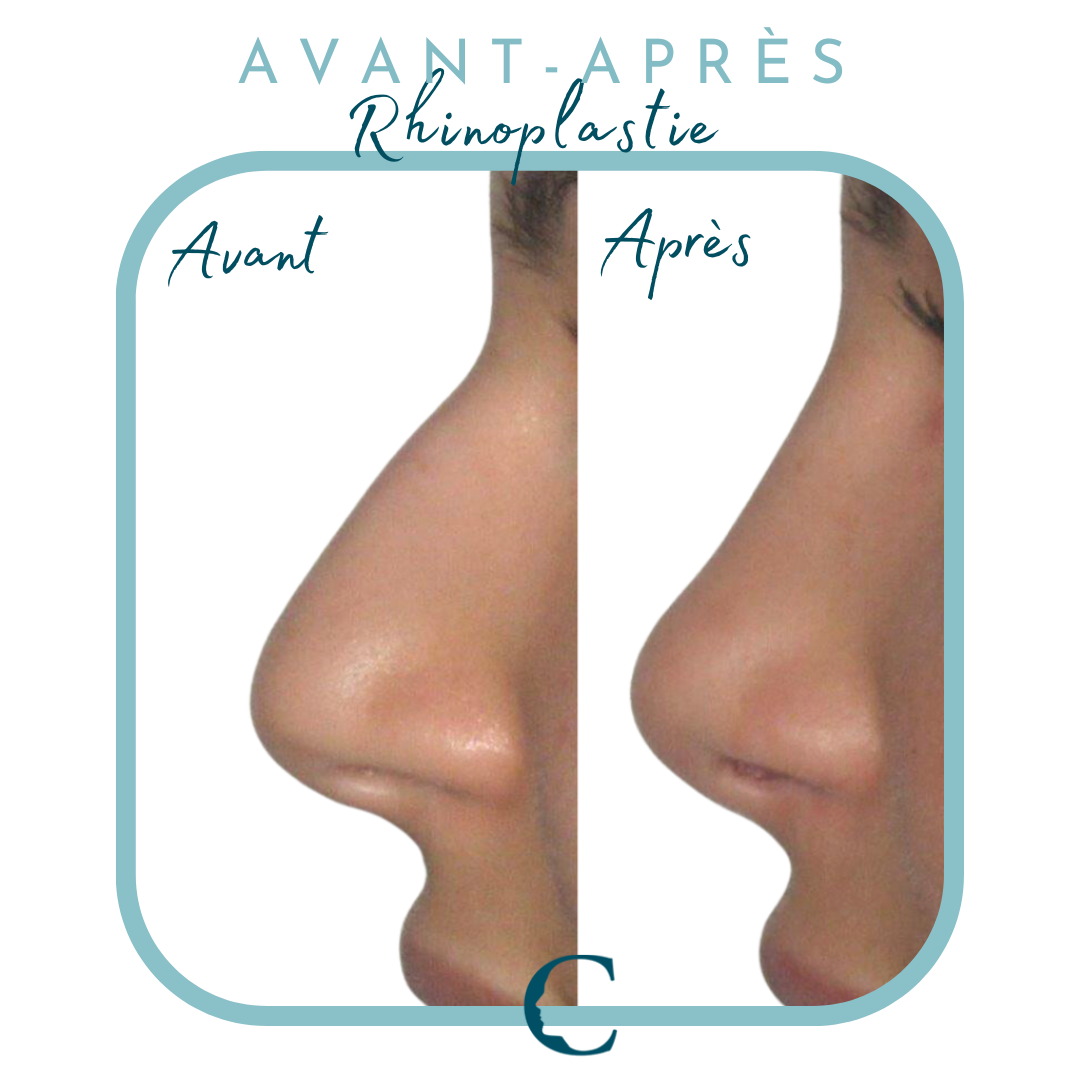 Chirurgie visage Lyon 