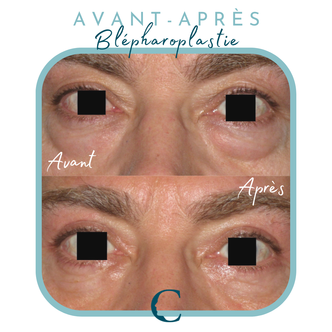  Chirurgie visage Lyon 