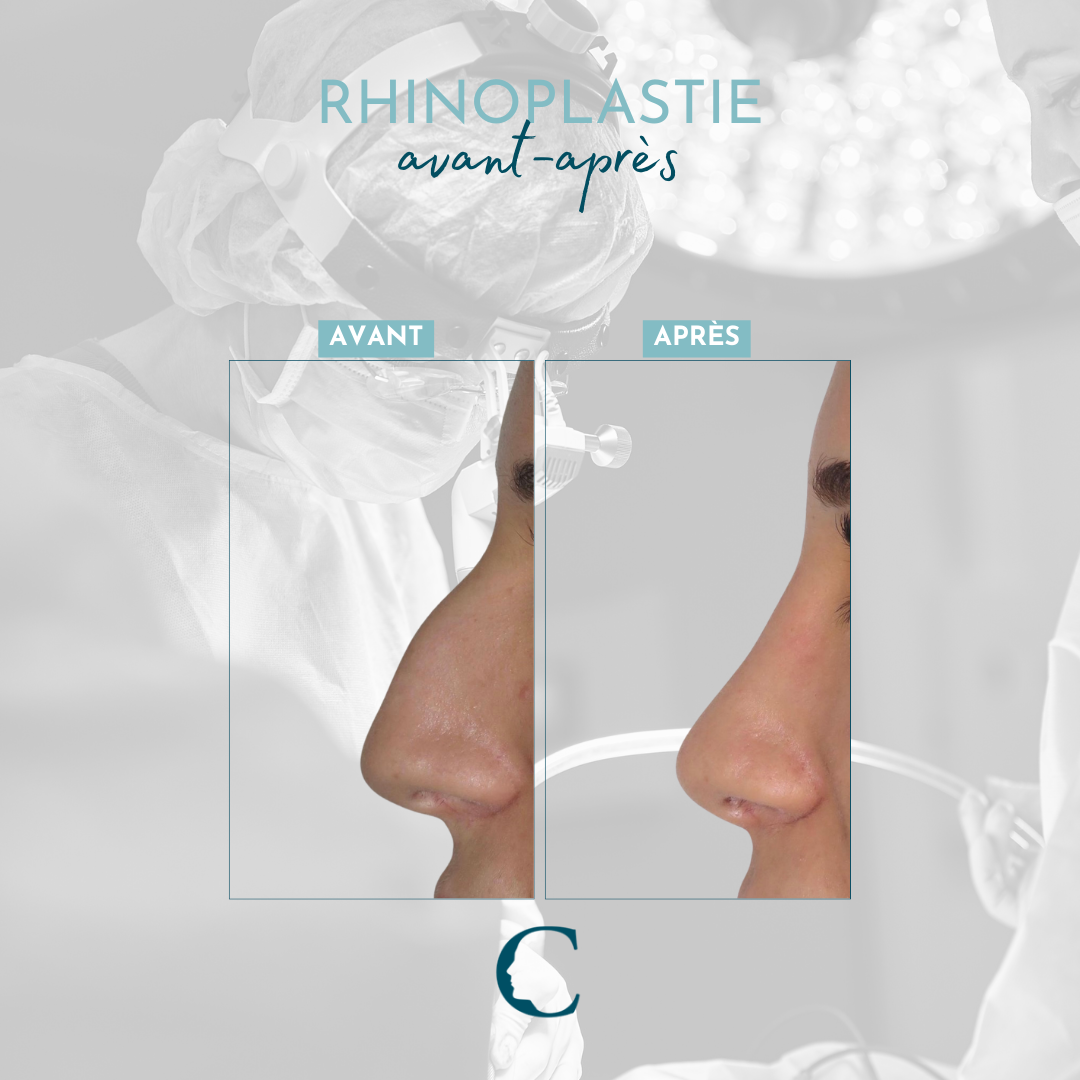 Chirurgie visage Lyon 