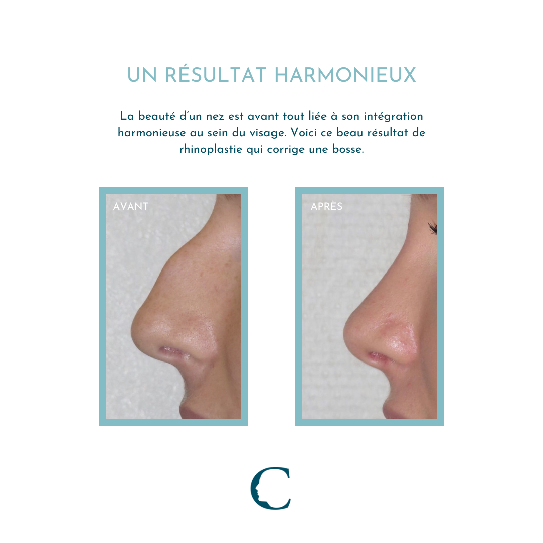 Chirurgie visage Lyon 