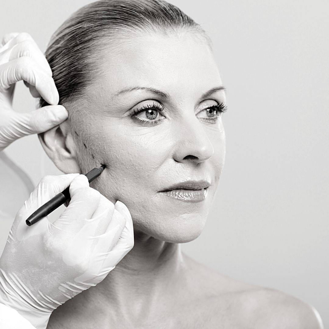 Le lifting visage pour vaincre les rides