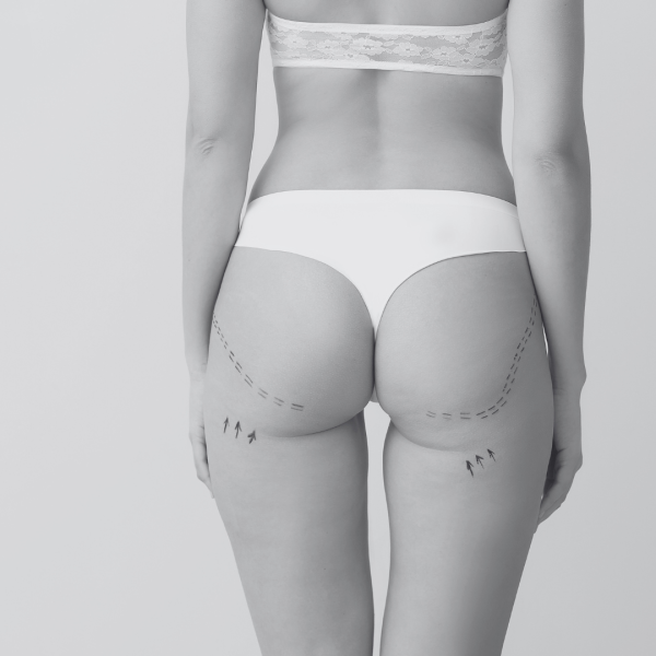 BBL près de Grenoble 