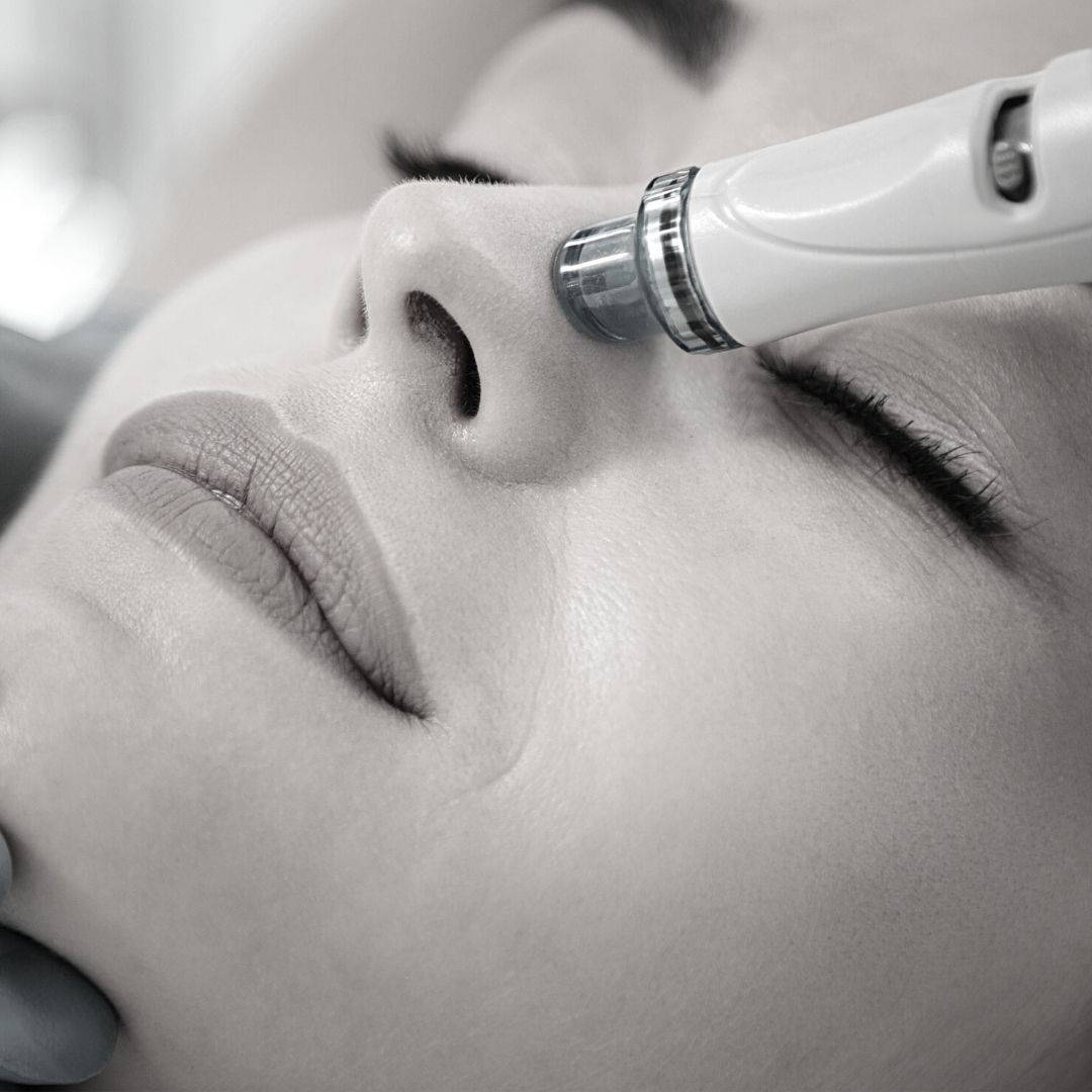 Comment éliminer les points noirs à Lyon ?